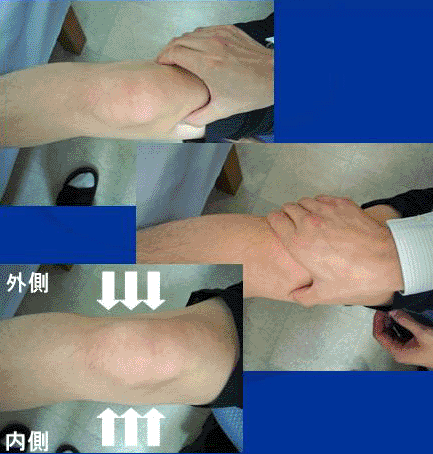 膝の痛みの原因を探す